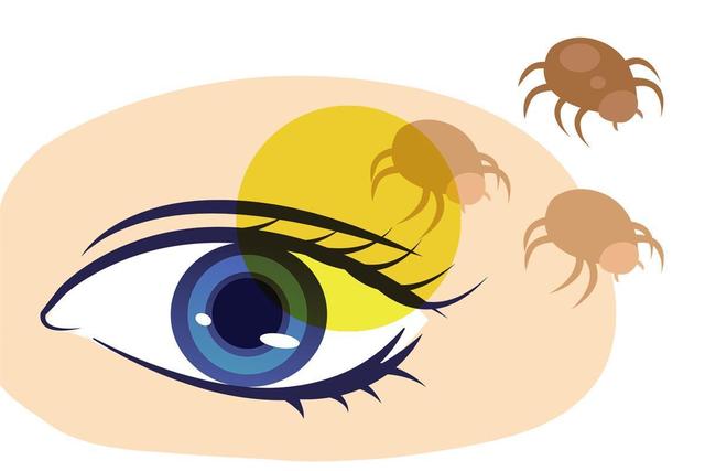 女主播眼睛無故干癢，竟因螨蟲爬滿睫毛