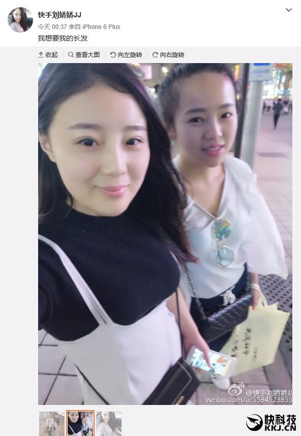 美女電鉆啃玉米變禿頂去看醫(yī)生：真悲劇了